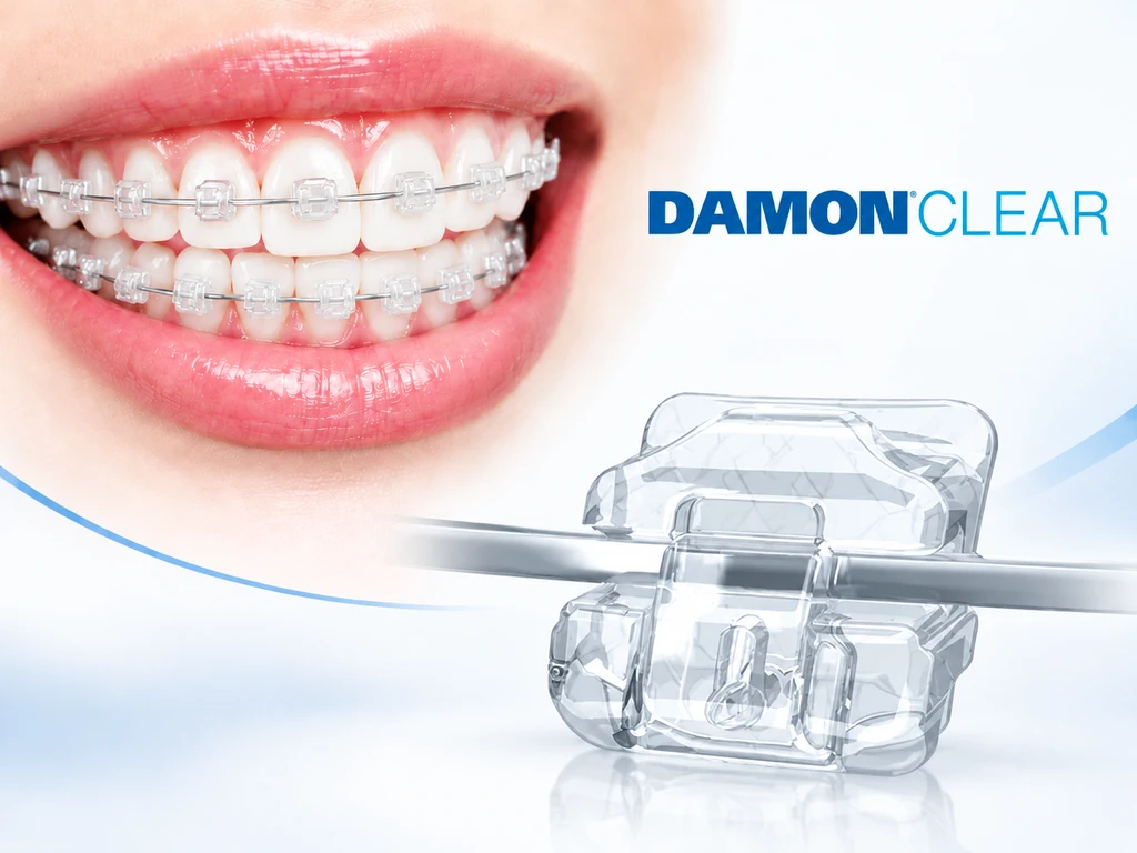 Сапфировые безлигатурные брекеты Damon Clear